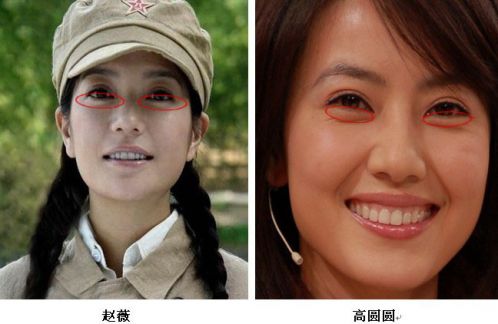 女人苹果脸卧蚕眼面相好不好分辨卧蚕和眼袋