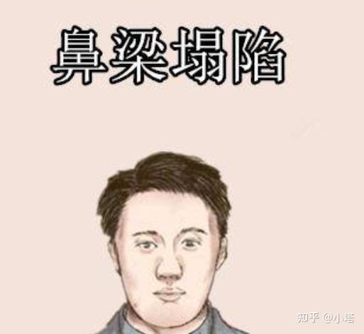 （李向东）鼻子丰隆直的人，怎样才算好？